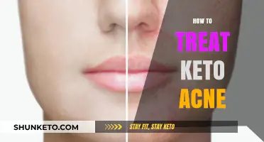 Conquering Keto Acne: A Comprehensive Guide to Clear Skin on the Ketogenic Diet
