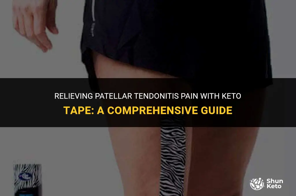 how to usw keto tape for patellar tendonitis