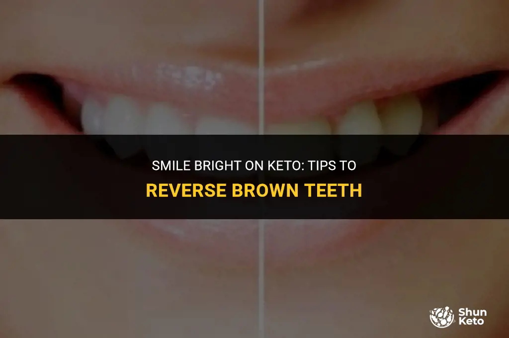 how to whiten keto brown teeth