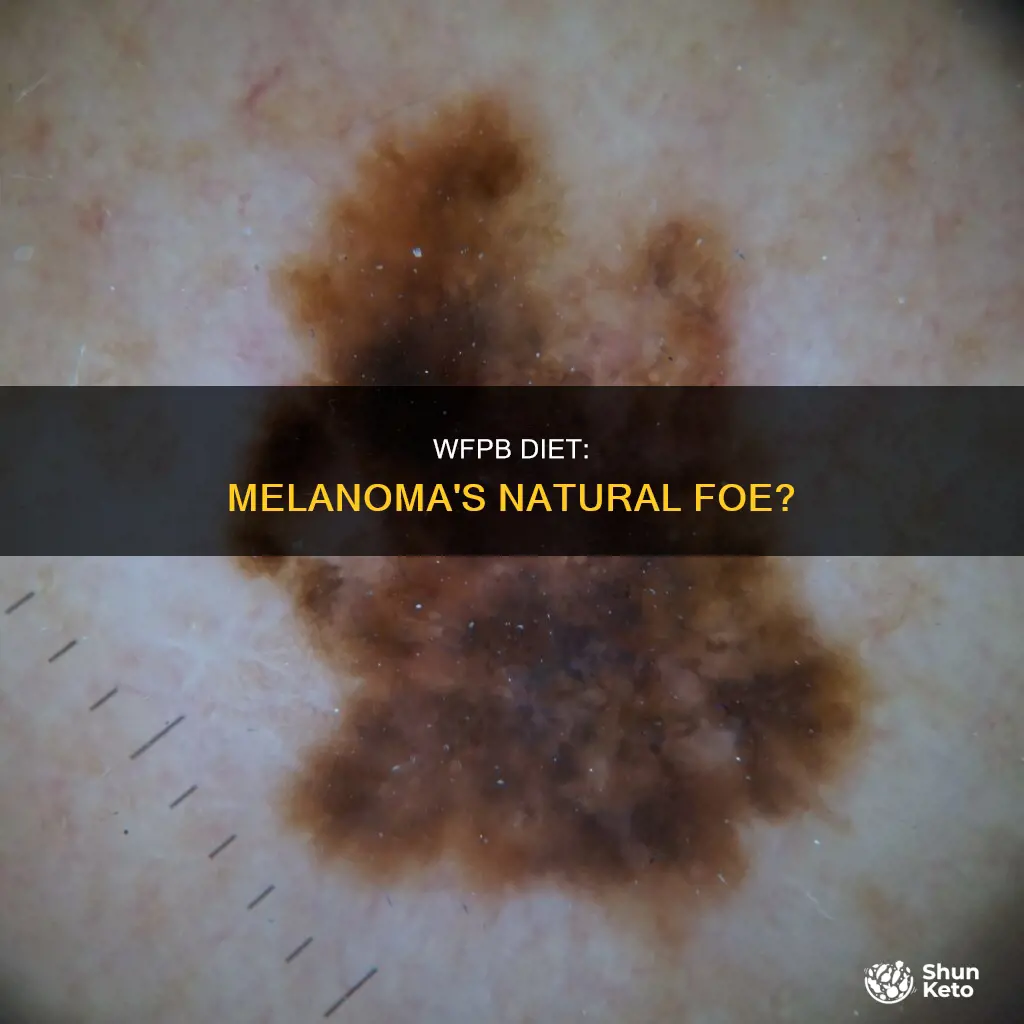 is a wfpb diet helpful in fighting melanoma