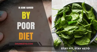 Acne and Diet: What's the Real Connection?