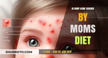 Baby Acne: Is Mom's Diet to Blame?