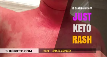 Candida Die-Off vs. Keto Rash: Understanding the Skin Symptoms
