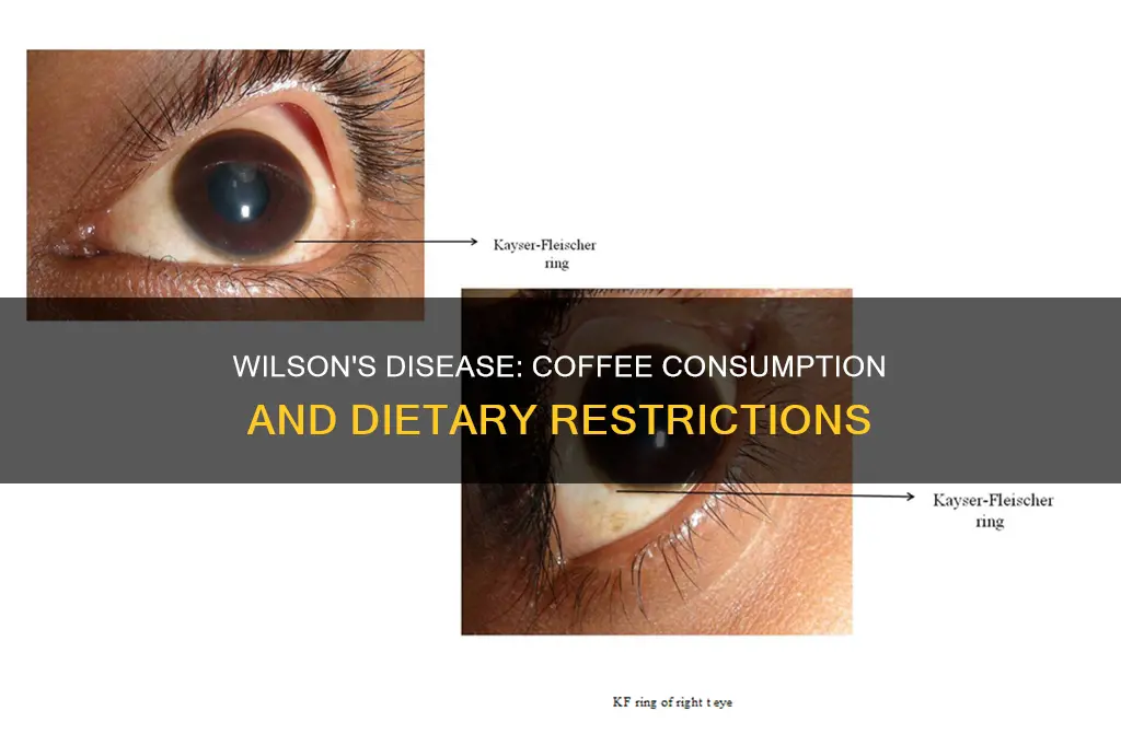 is coffee allowed on wilsons disease diet