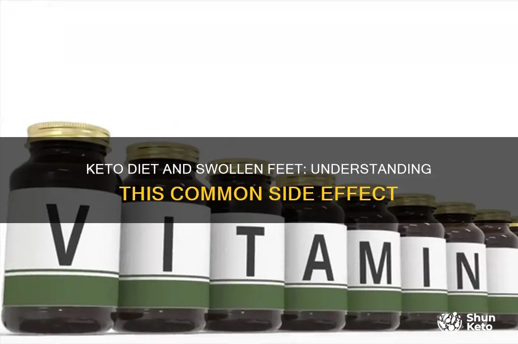 is it normal for feet to swell on keto diet