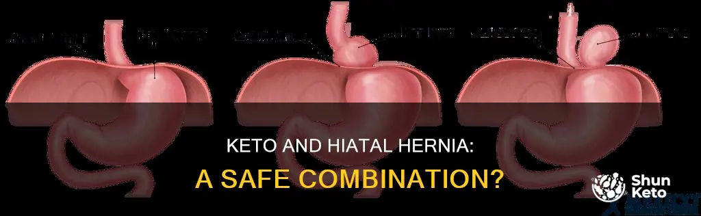 is it okay to do keto with a hiatal hernia