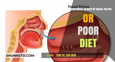 Nasal Polyps or Poor Diet: What's Stuffing You Up?