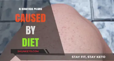 Keratosis Pilaris: Can Diet Cause This Skin Condition?