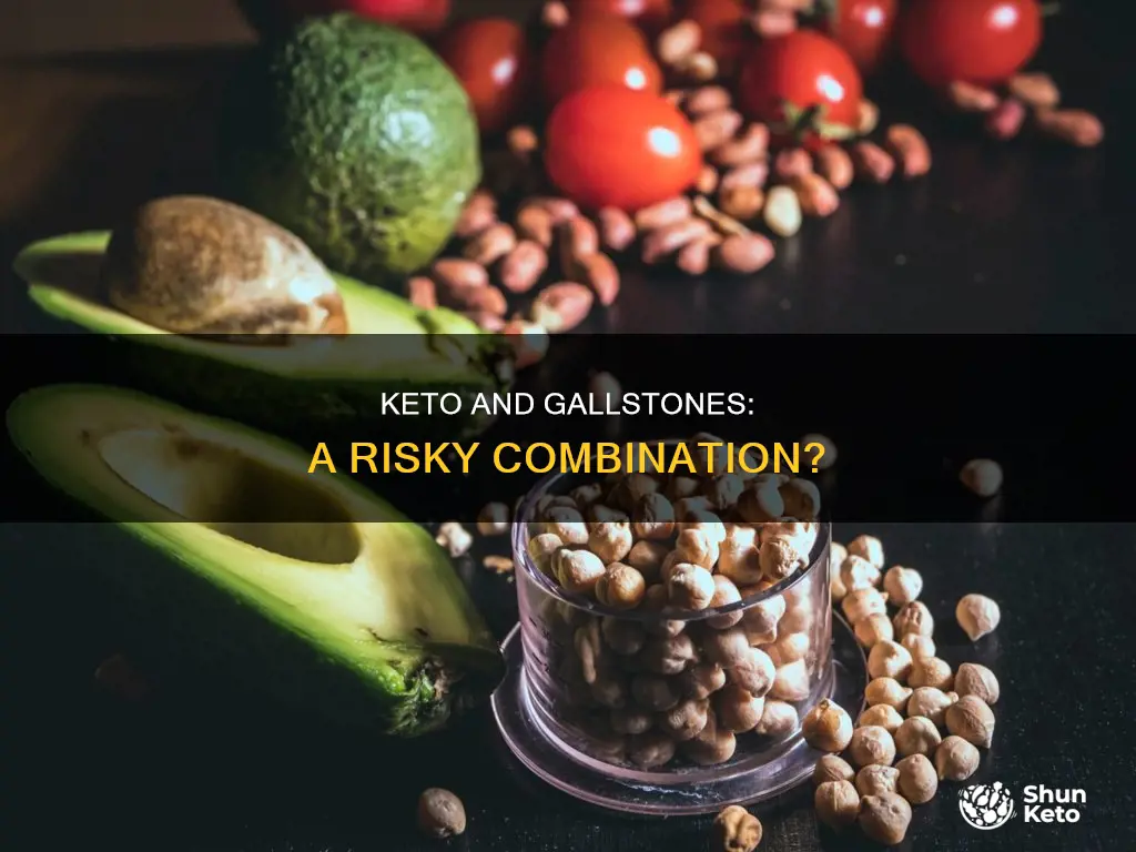 is keto a bad idea if you have gall stones