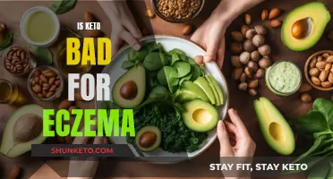 Keto Diet: Friend or Foe for Eczema Sufferers?