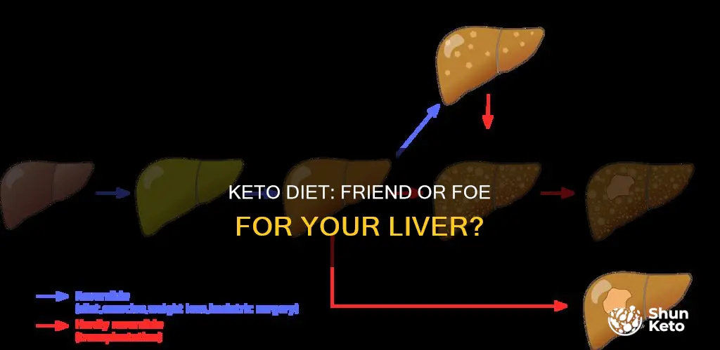 is keto bad for luver