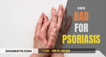 Keto Diet: Friend or Foe for Psoriasis?