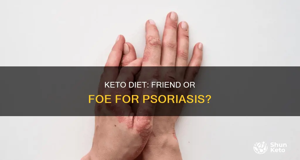 is keto bad for psoriasis