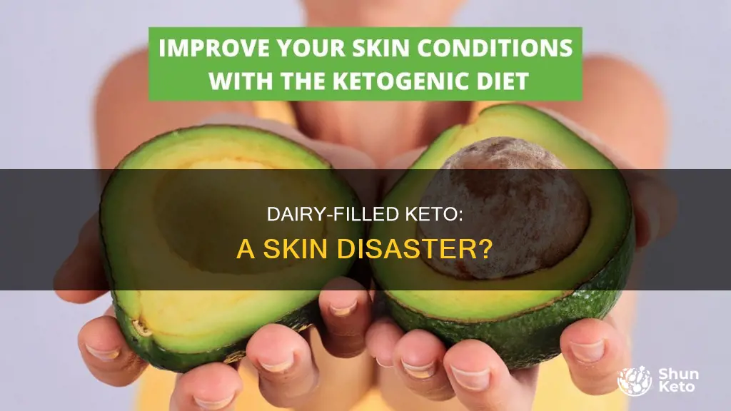 is keto bad for your skin because of the dairy