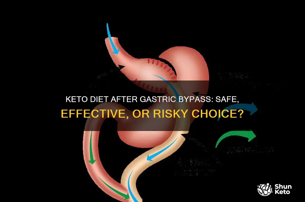 is keto diet ok for gastric bypass patients