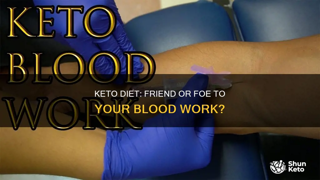 is keto good for blood work