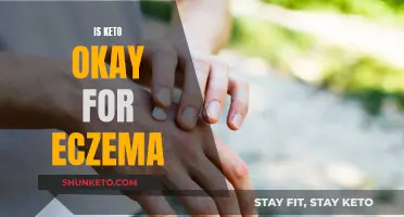 Keto Diet: Friend or Foe for Eczema Sufferers?