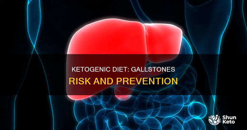 is ketogenic diet cause gallstones
