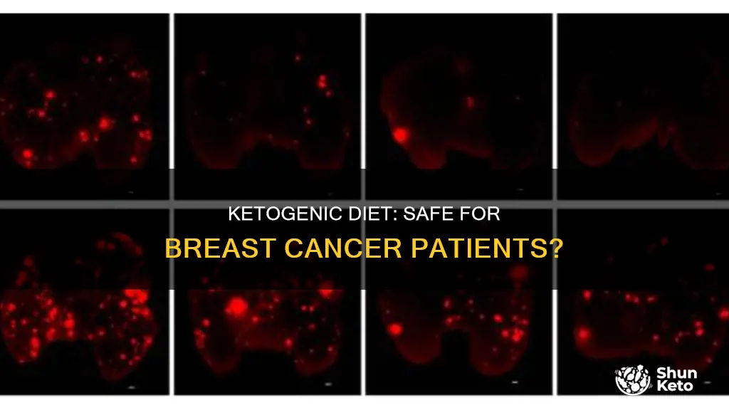is ketogenic diet safe for breast cancer