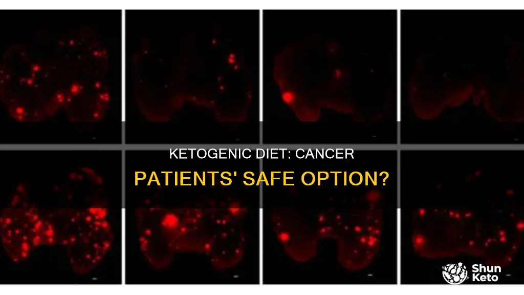 is ketogenic diet safe for cancer patients