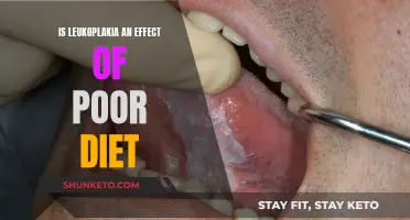 Leukoplakia: Poor Diet's Role in Oral Health