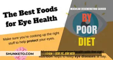 Macular Degeneration: Diet's Impact and Prevention