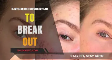 Lean Diet: Skin Breakout Culprit?