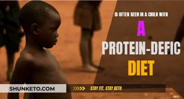 Child Diet: Protein Deficiency and Its Impact