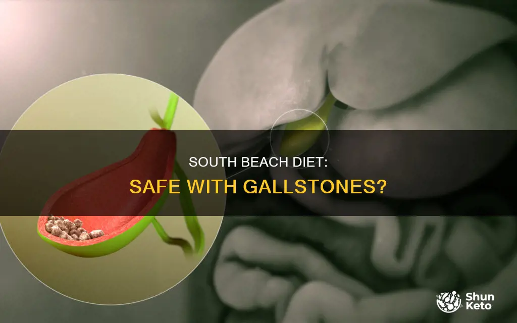 is south beach diet safe for those with gallstones