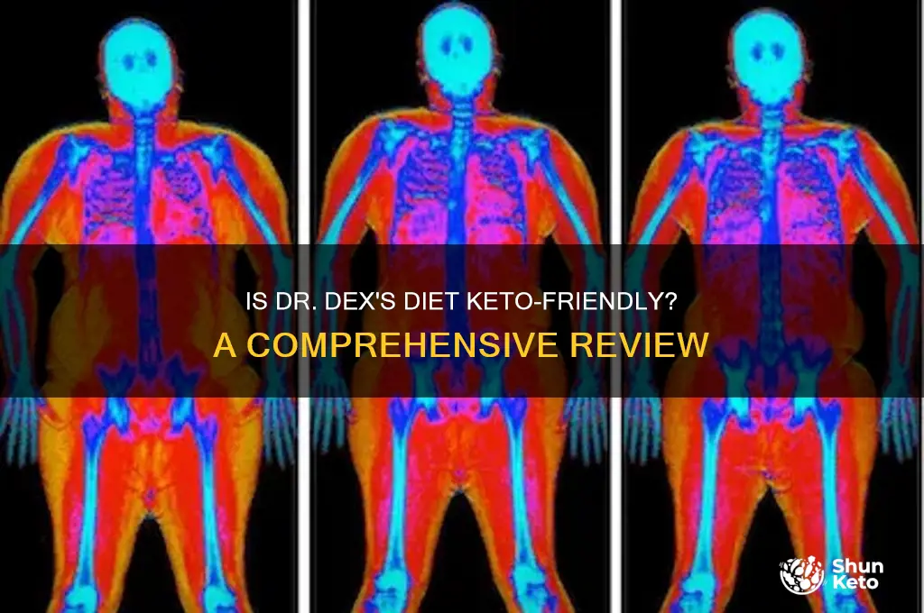 is start dr dex diet keto