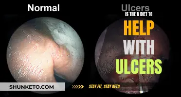 Healing Ulcers: The Right Diet