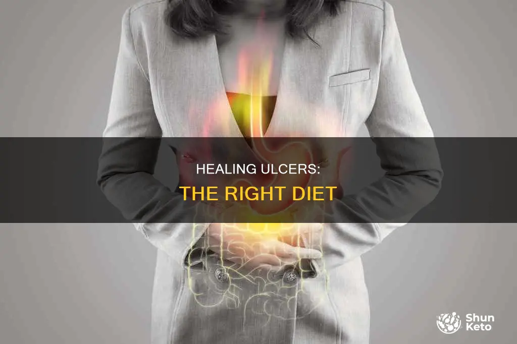 is the a diet to help with ulcers