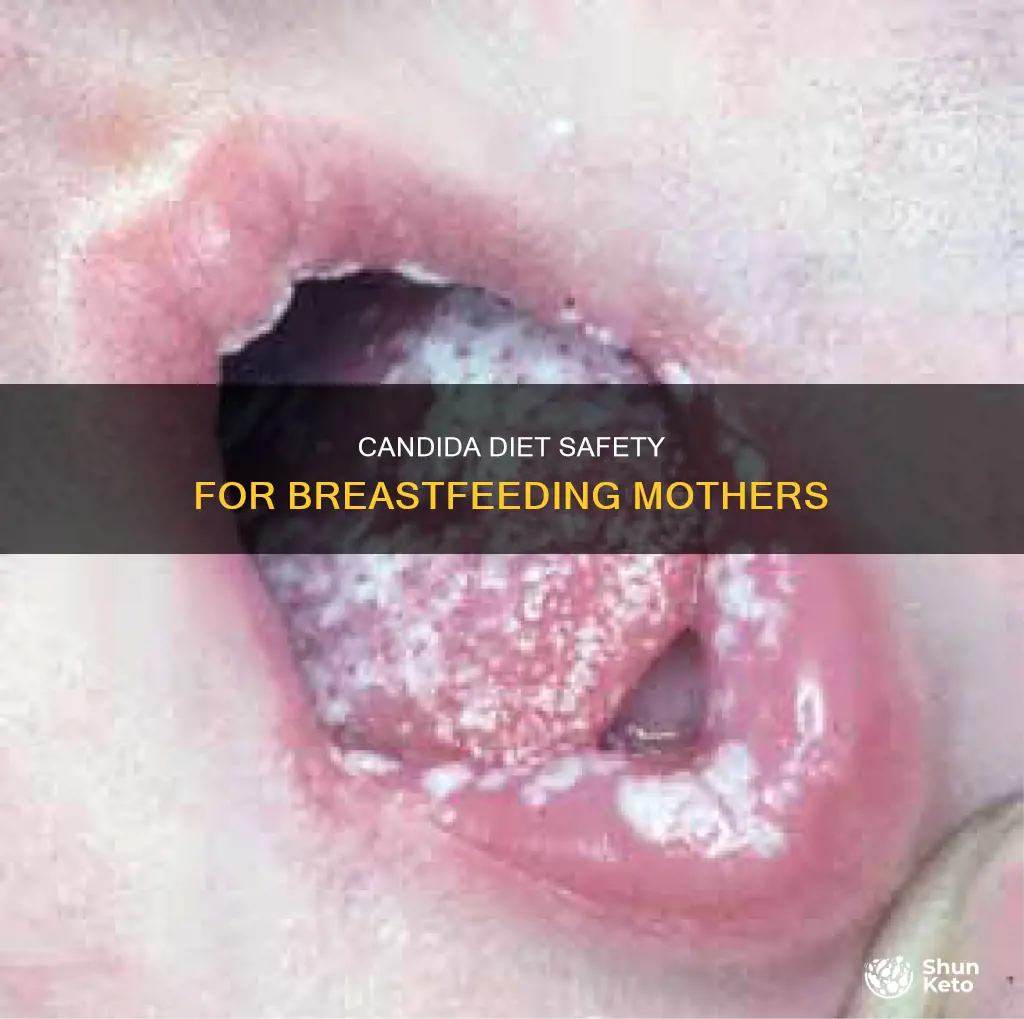 is the candida diet safe while breastfeeding