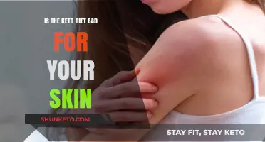 Keto Diet and Skin Health: Benefits or Potential Risks?