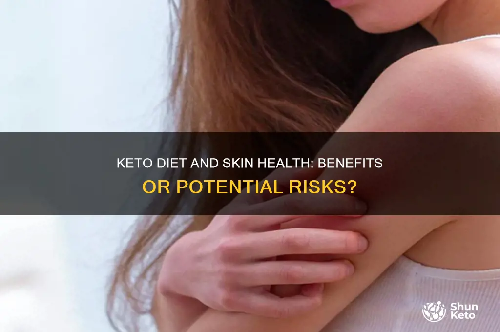 is the keto diet bad for your skin