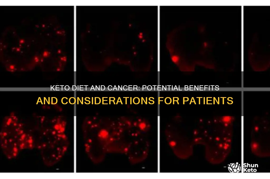 is the keto diet beneficial to cancer patients