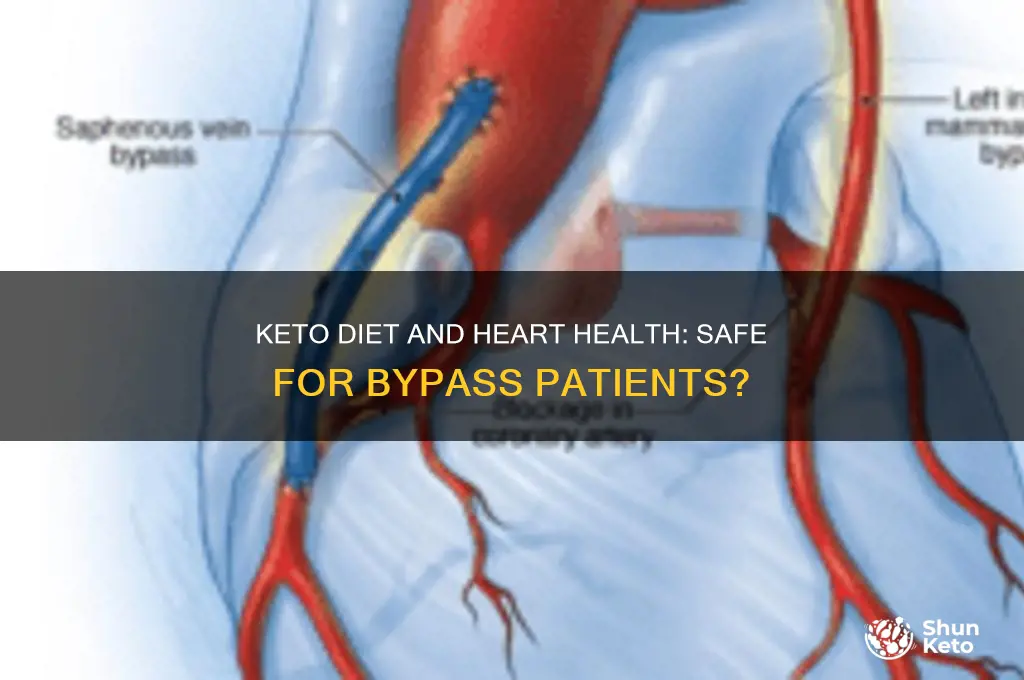 is the keto diet healthy for heart bypass patients