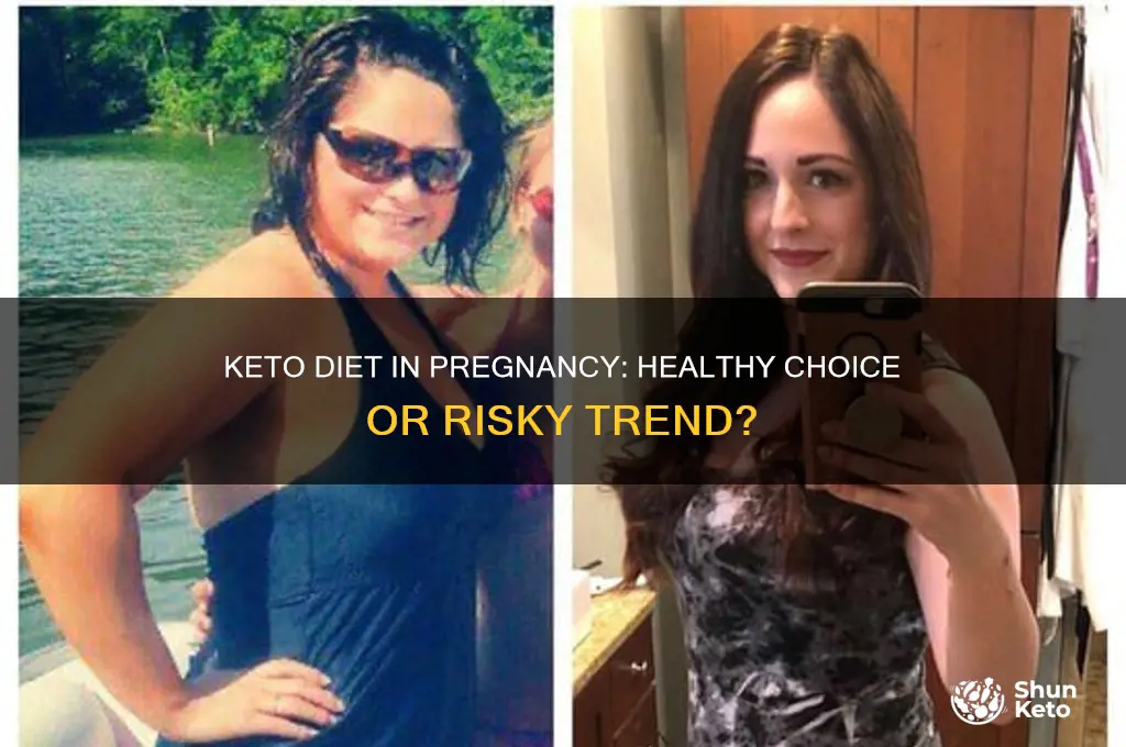 is the keto diet healthy for pregnancy