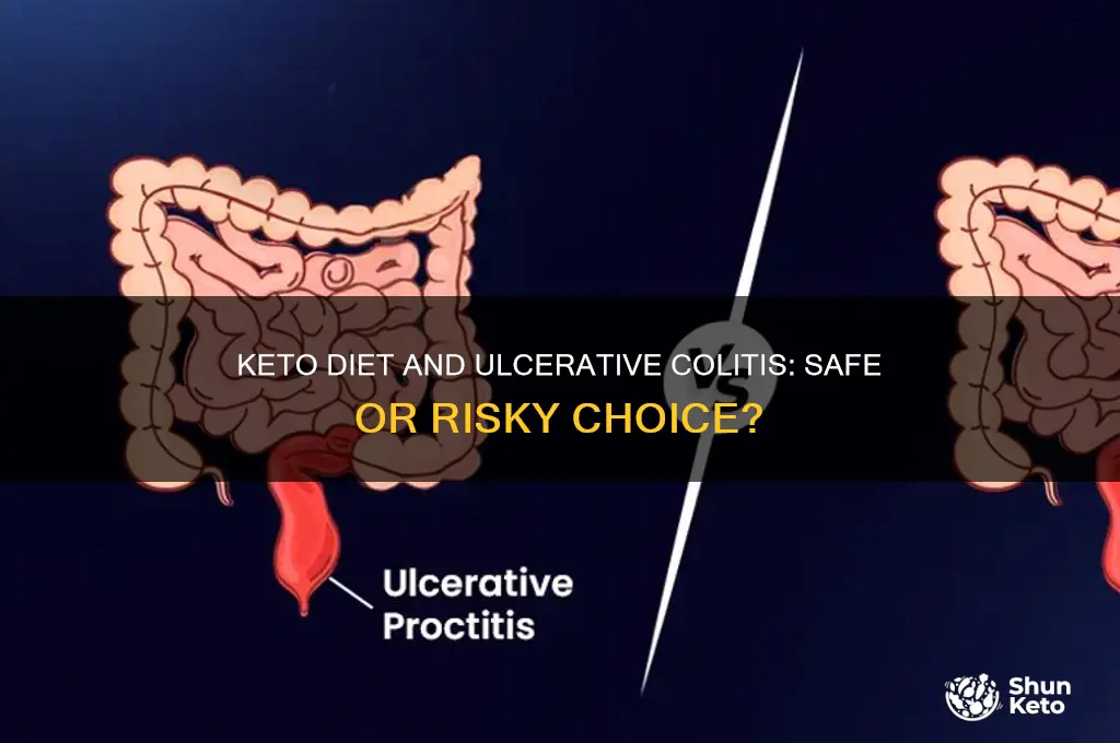 is the keto diet safe for ulcerative colitis