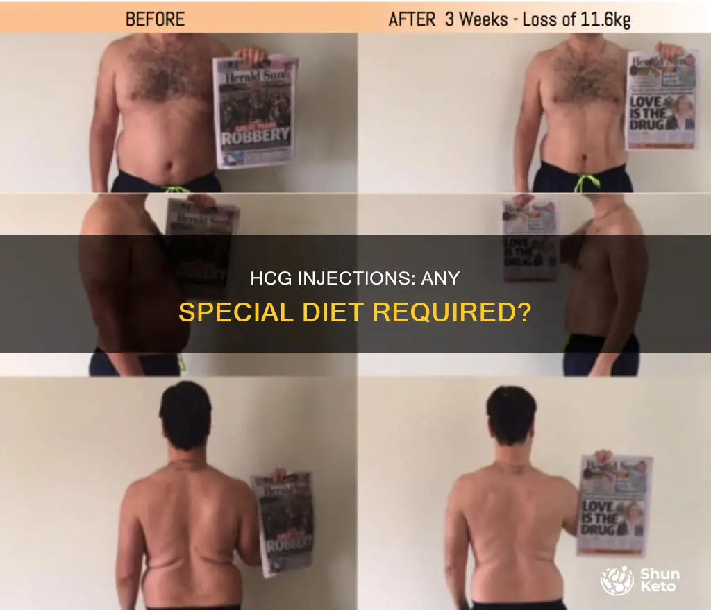 is theee a special diet with hcg injections