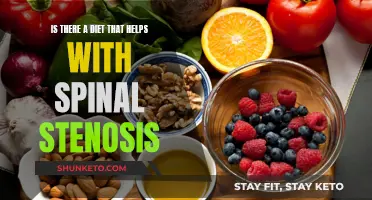 Spinal Stenosis: Can Diet Help?
