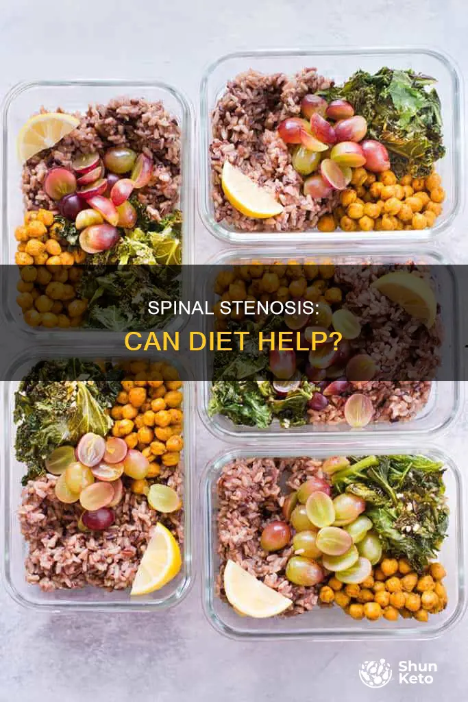 is there a diet that helps with spinal stenosis