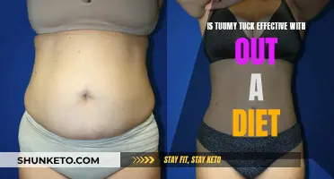 Tummy Tuck Without Diet: Is It Effective?