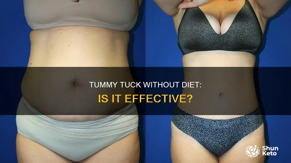 is tuumy tuck effective with out a diet
