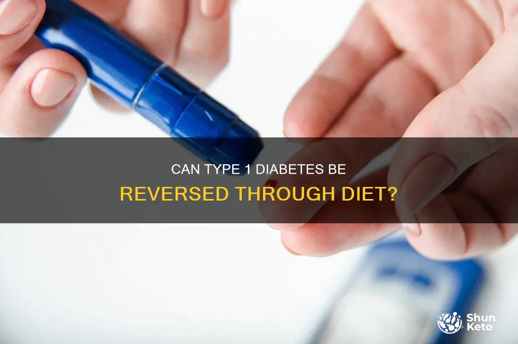 is type 1 diabetes reversible with diet