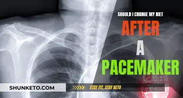 Diet Adjustments After a Pacemaker: What You Need to Know