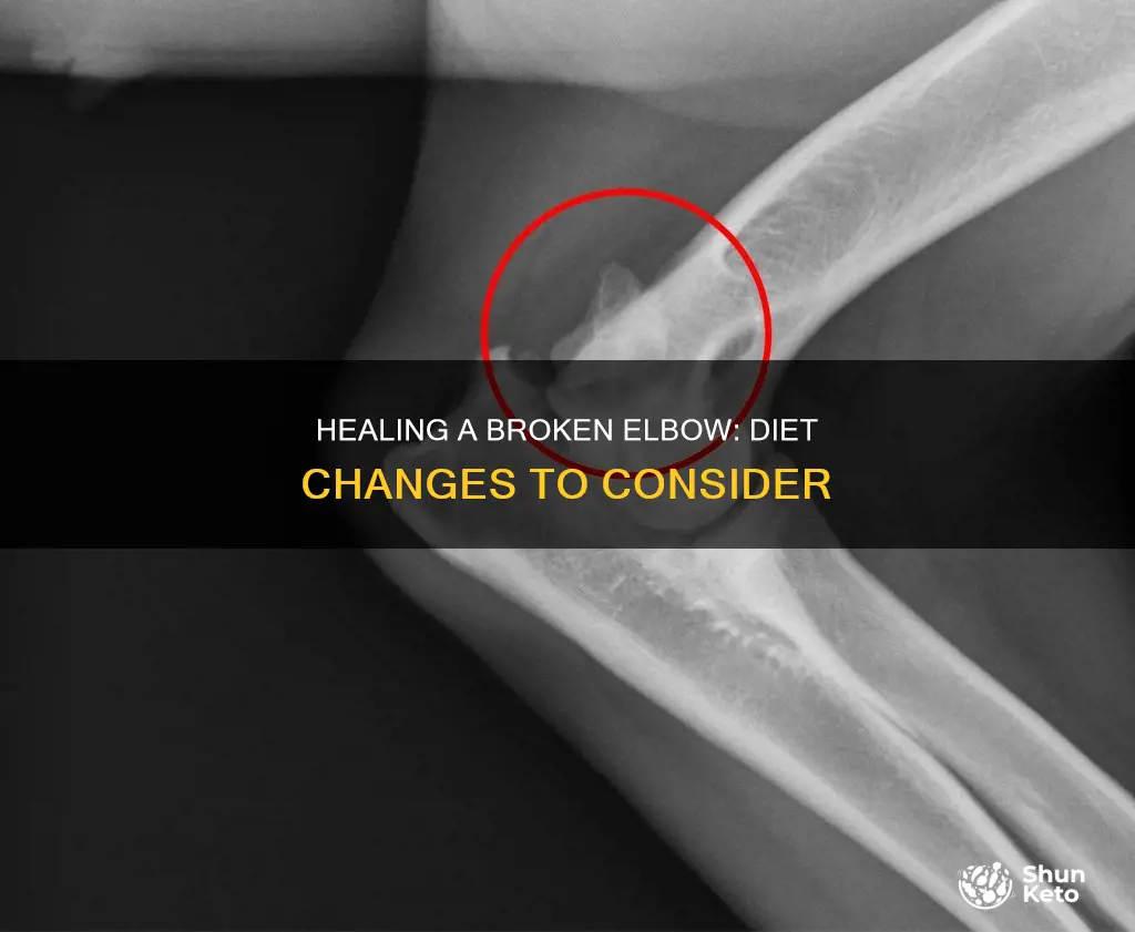 should i change my diet after breaking elbow