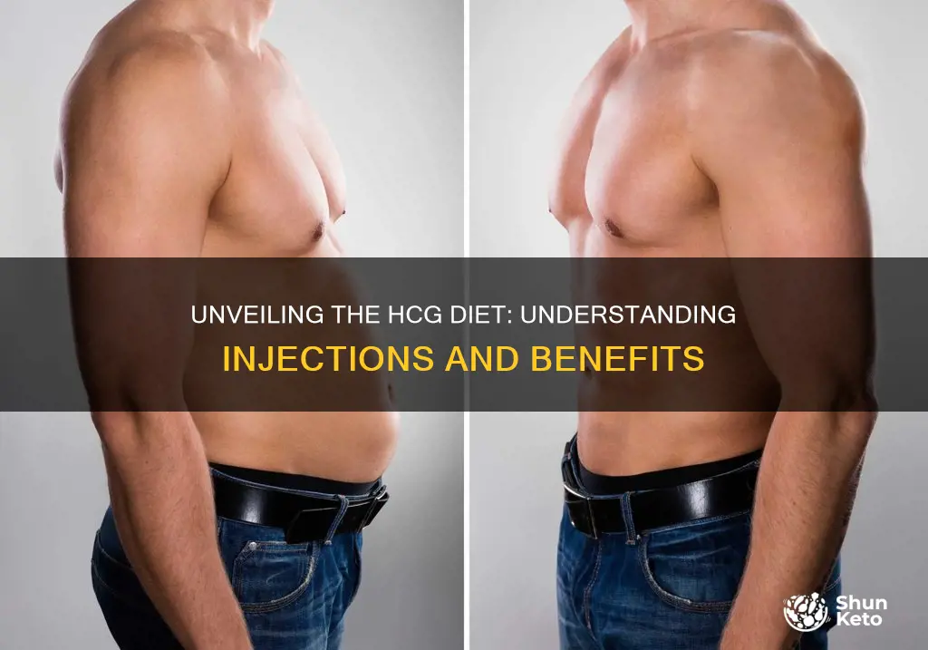 what are hcg diet injections