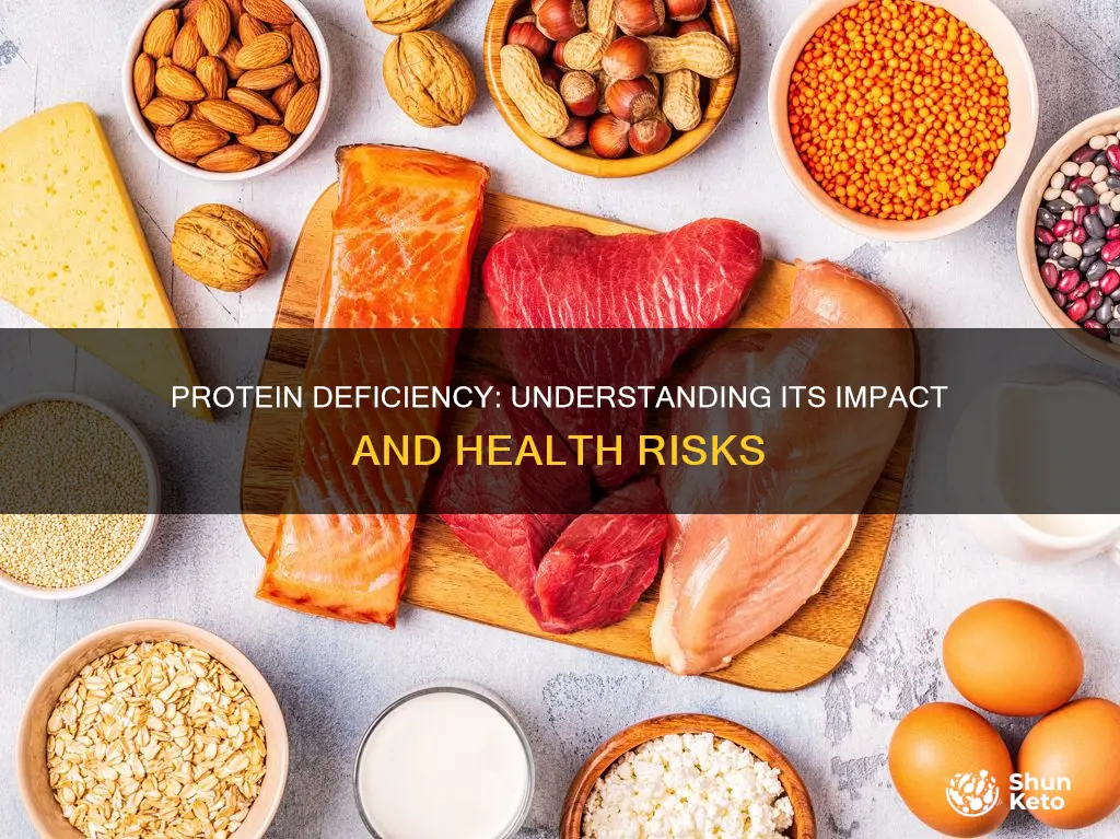 what are the effects of proteins deficiency in the diet
