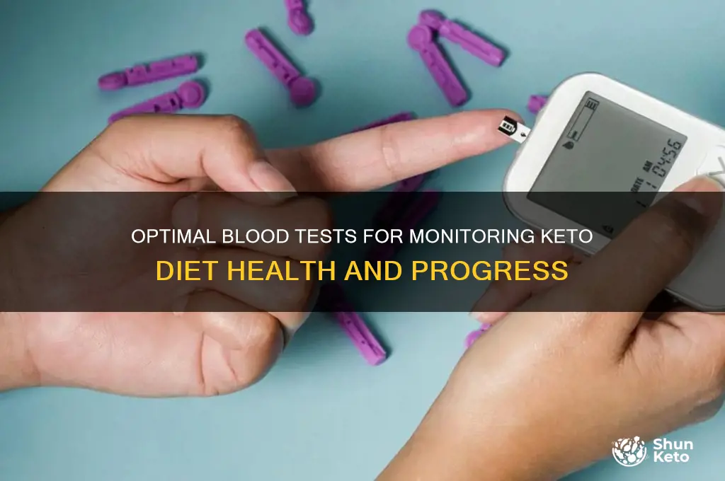 what blood test is best whil eon the keto diet